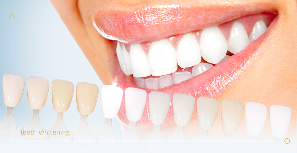 How Veneers Influence Chewing Efficiency and Digestive Wellness